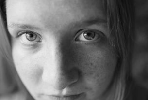 Effacer les taches du visage : causes, préventions et traitements