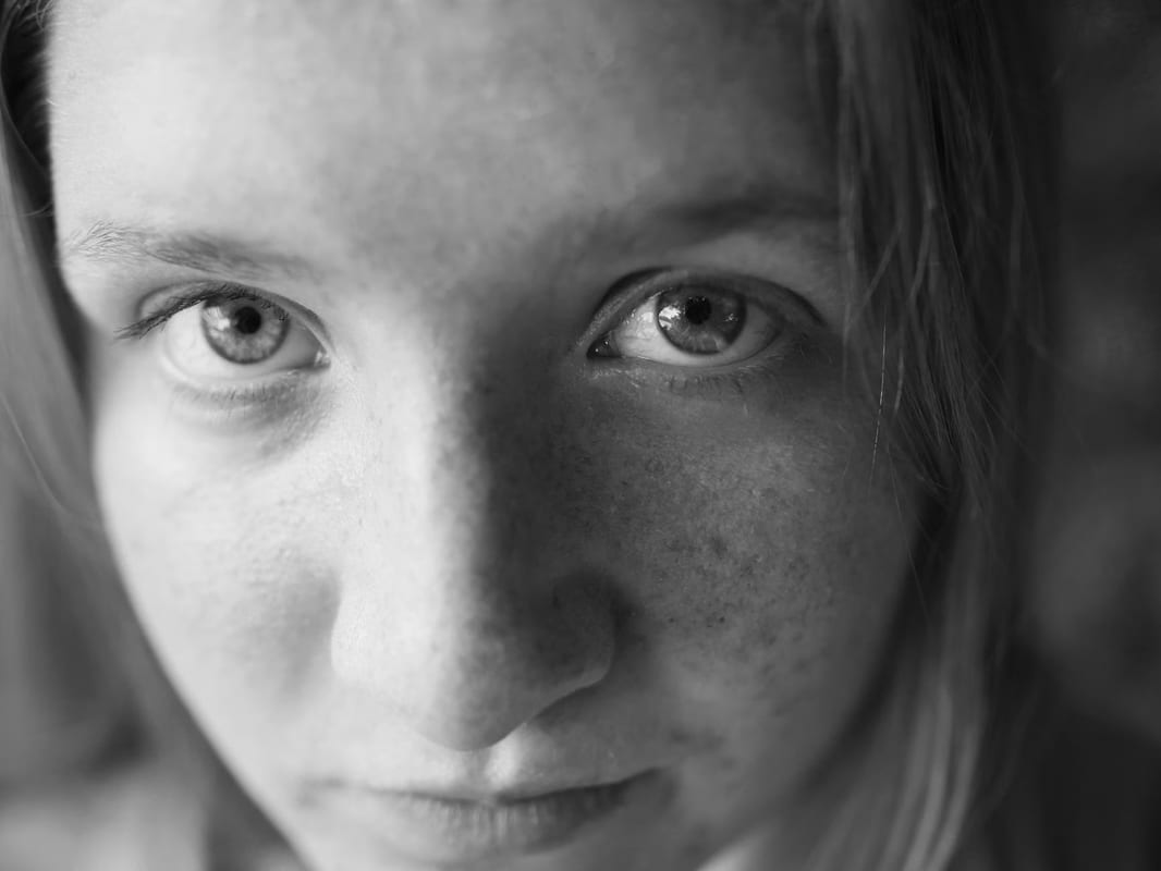 Effacer les taches du visage : causes, préventions et traitements